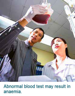 Abnormal blood tests Singapore General Hospital