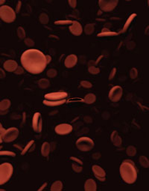 lack of red blood cells indicating anaemia