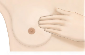 self examination on breast cancer
