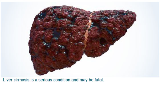 liver with liver cirrhosis 