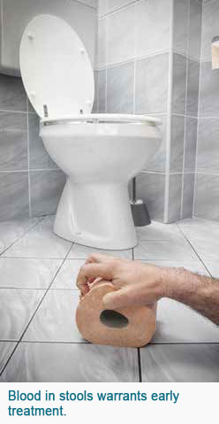 Per Rectal Bleeding Singapore General Hospital