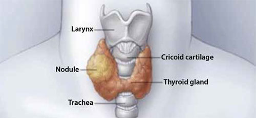Image showing position of thyroid gland in neck among other organs - SingHealth